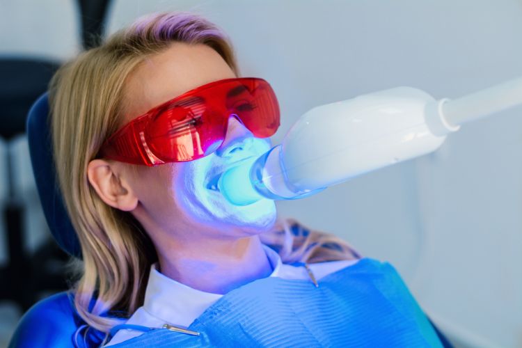 blanqueamiento dental activacion luz