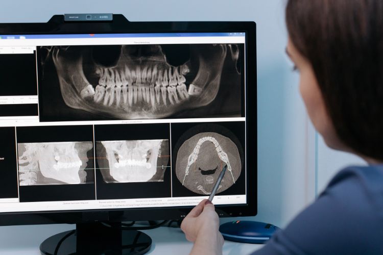 radiografia dental