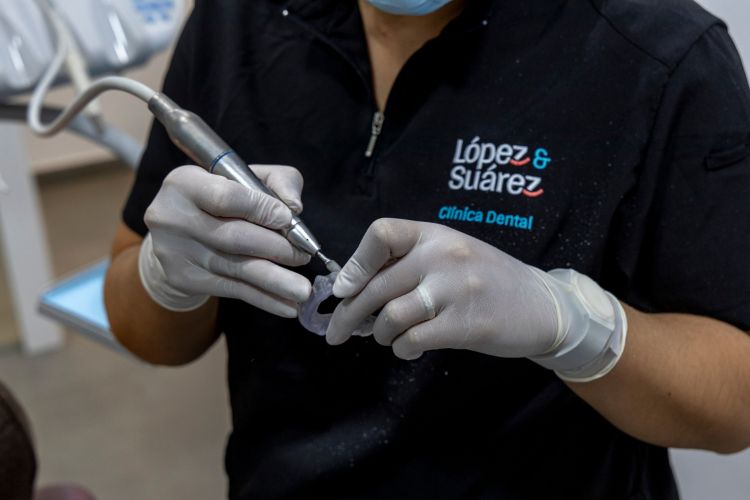 ferula para el bruxismo en clinica dental