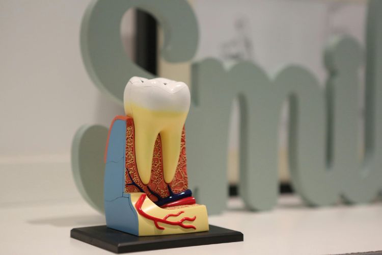 modelo de diente en 3d