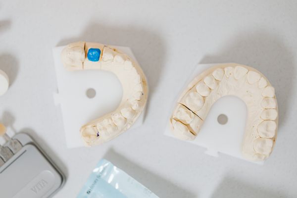 moldes dentadura para implantes