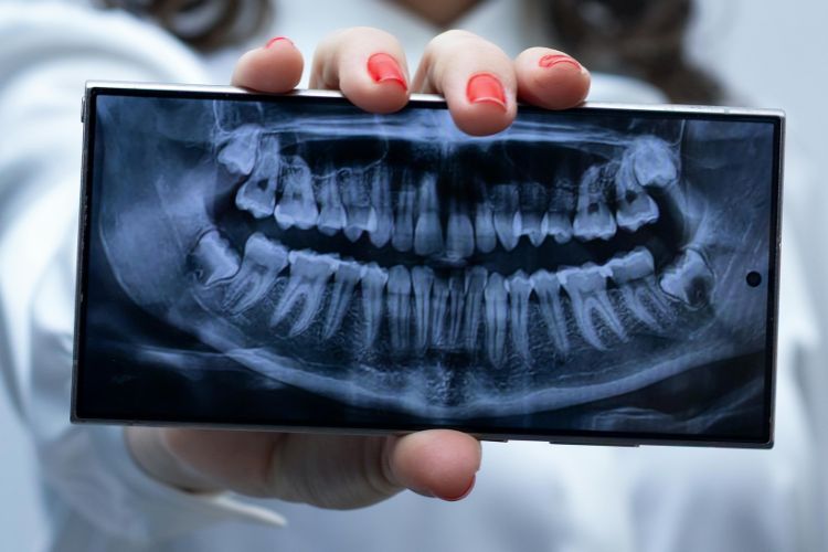 radiografia boca y dientes