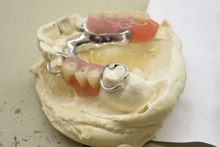 maqueta dental protesis dental